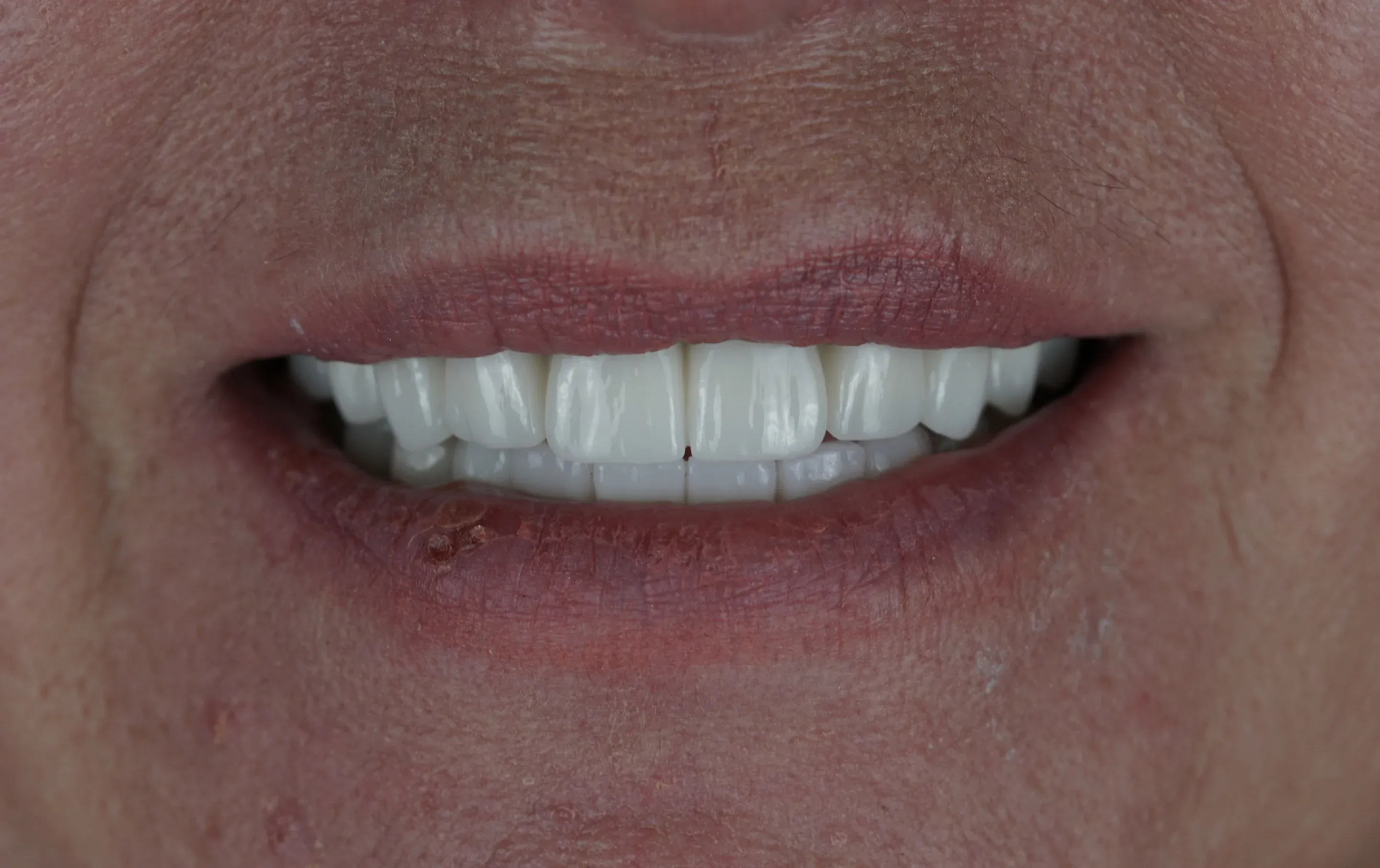Image two