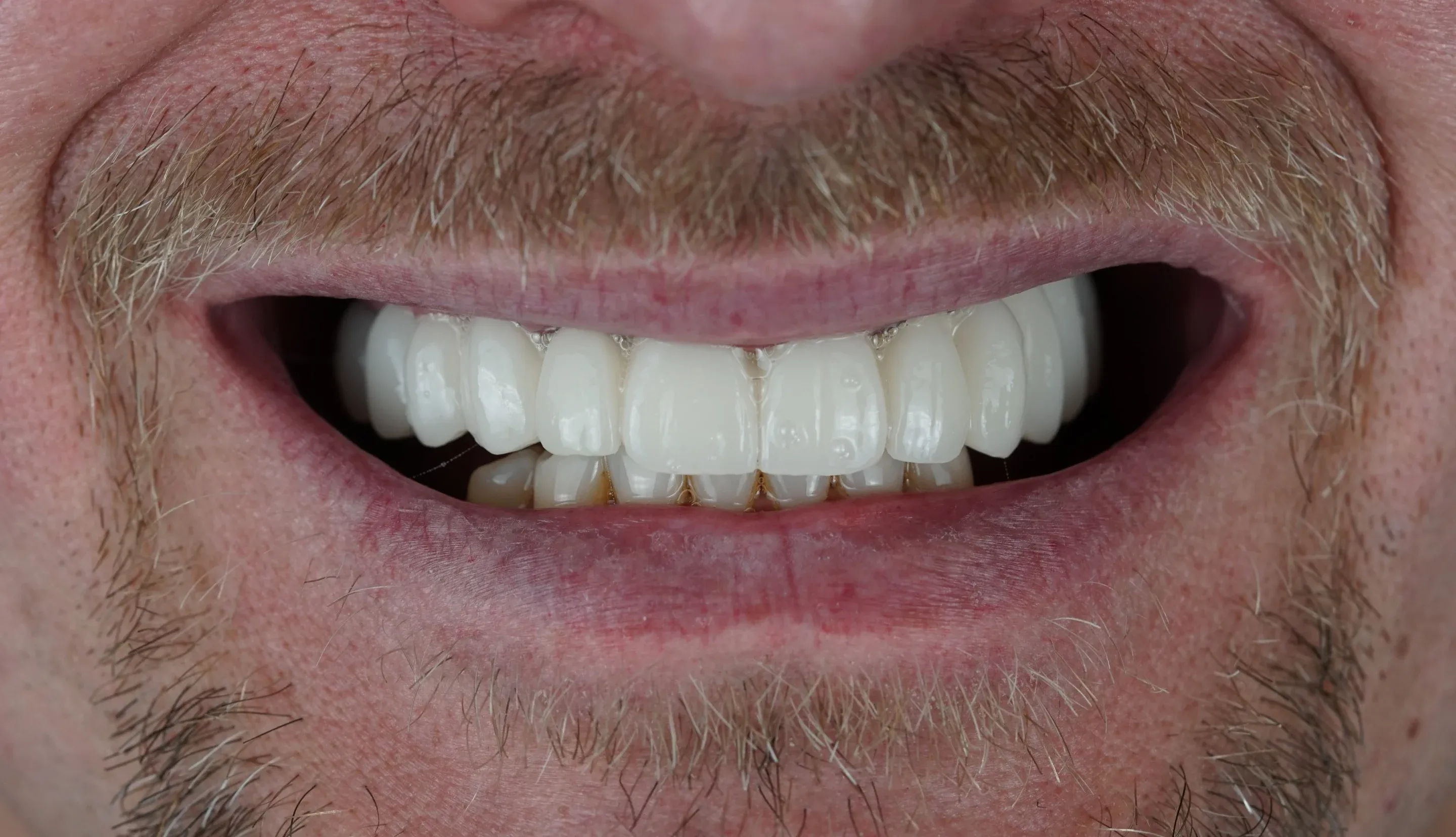 Image two