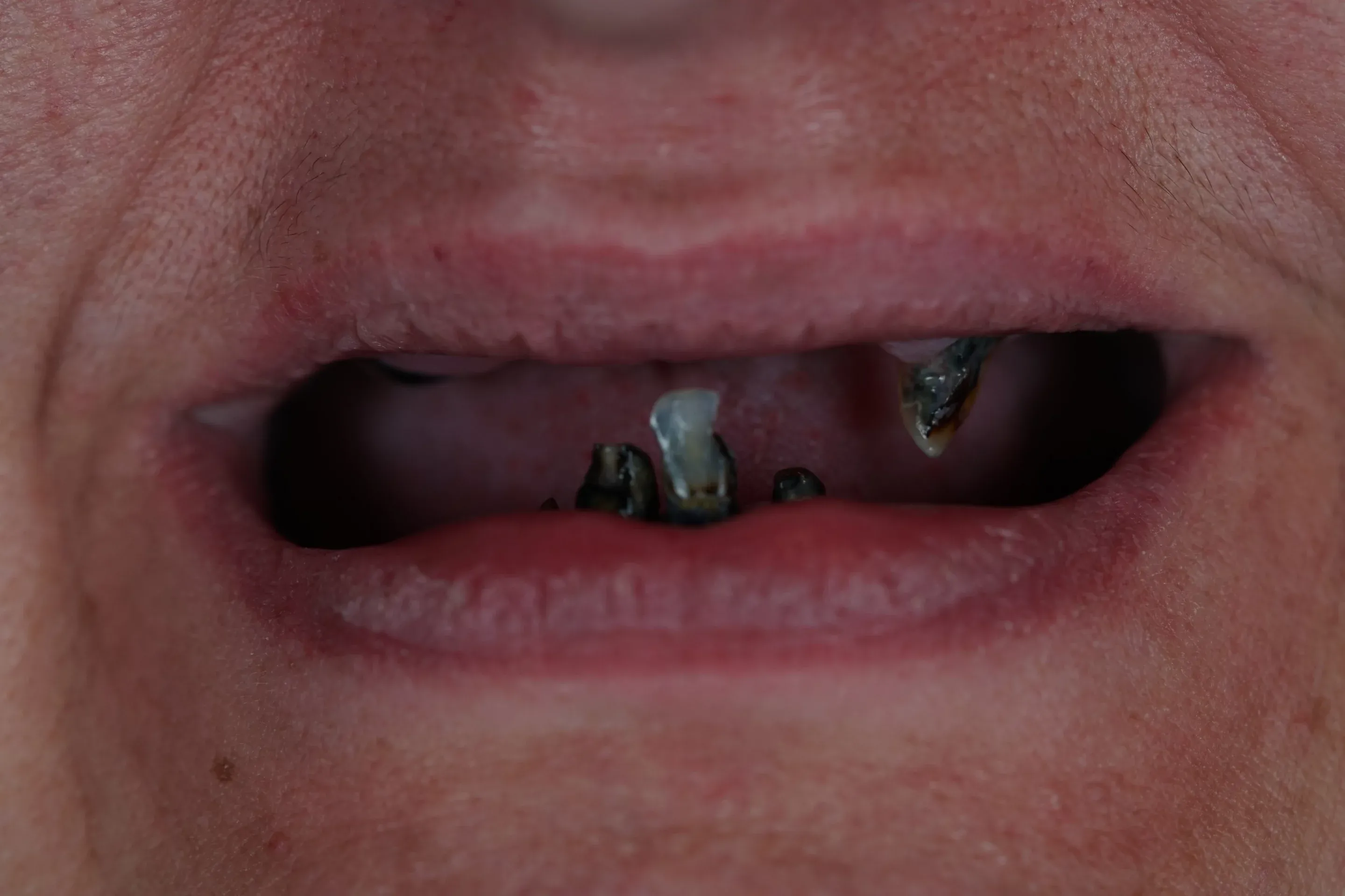 Image one
