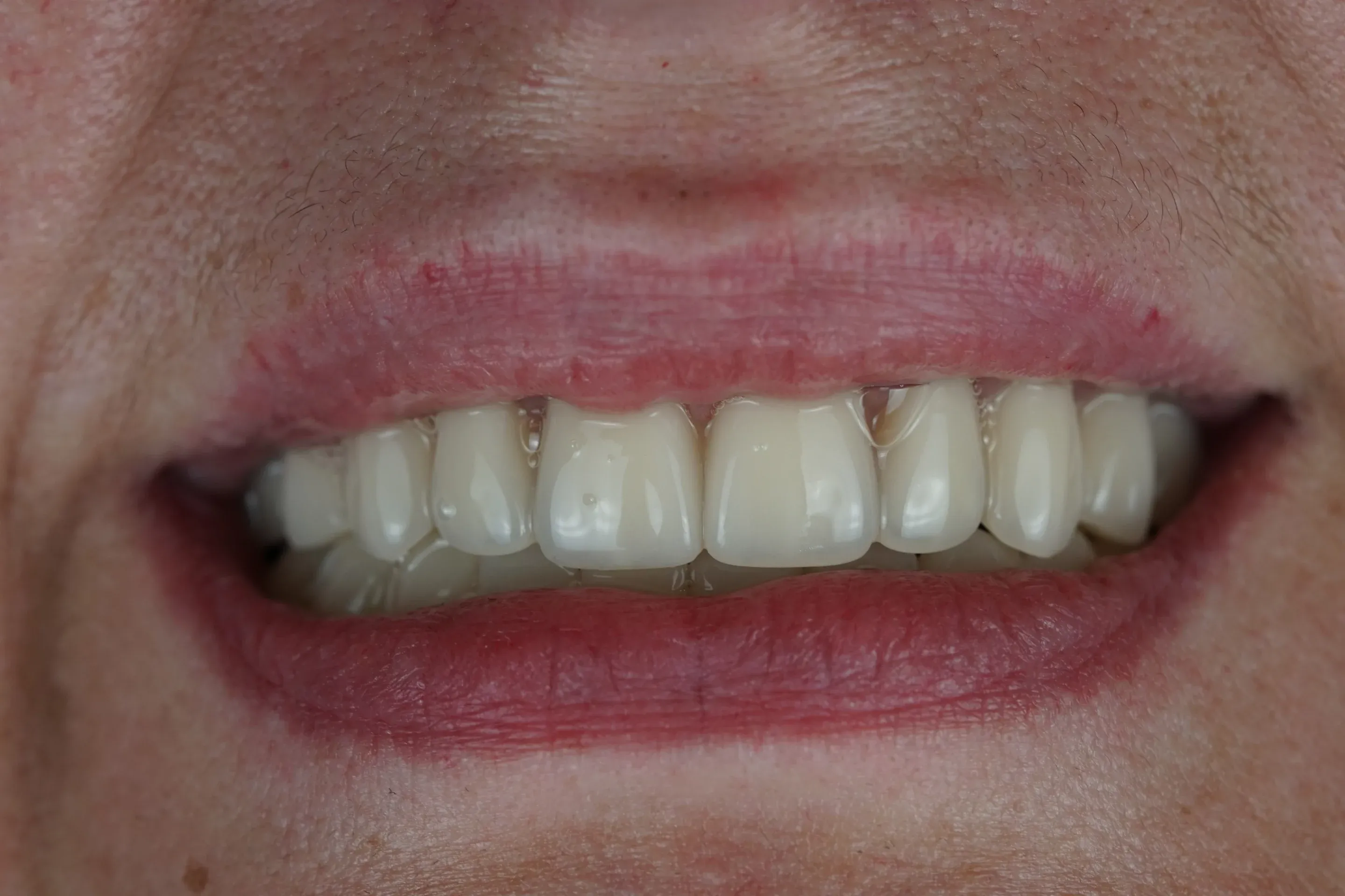 Image two