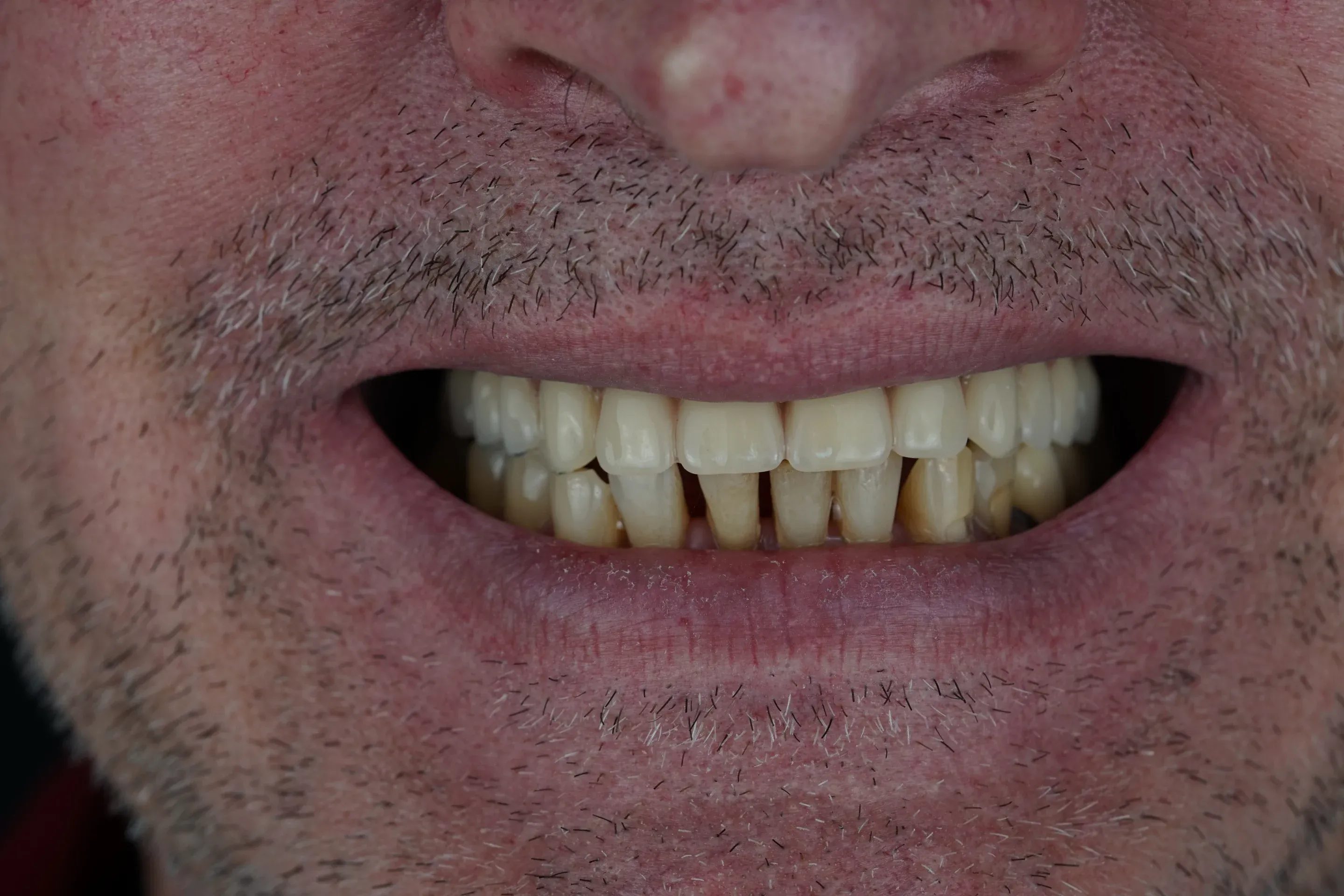 Image two