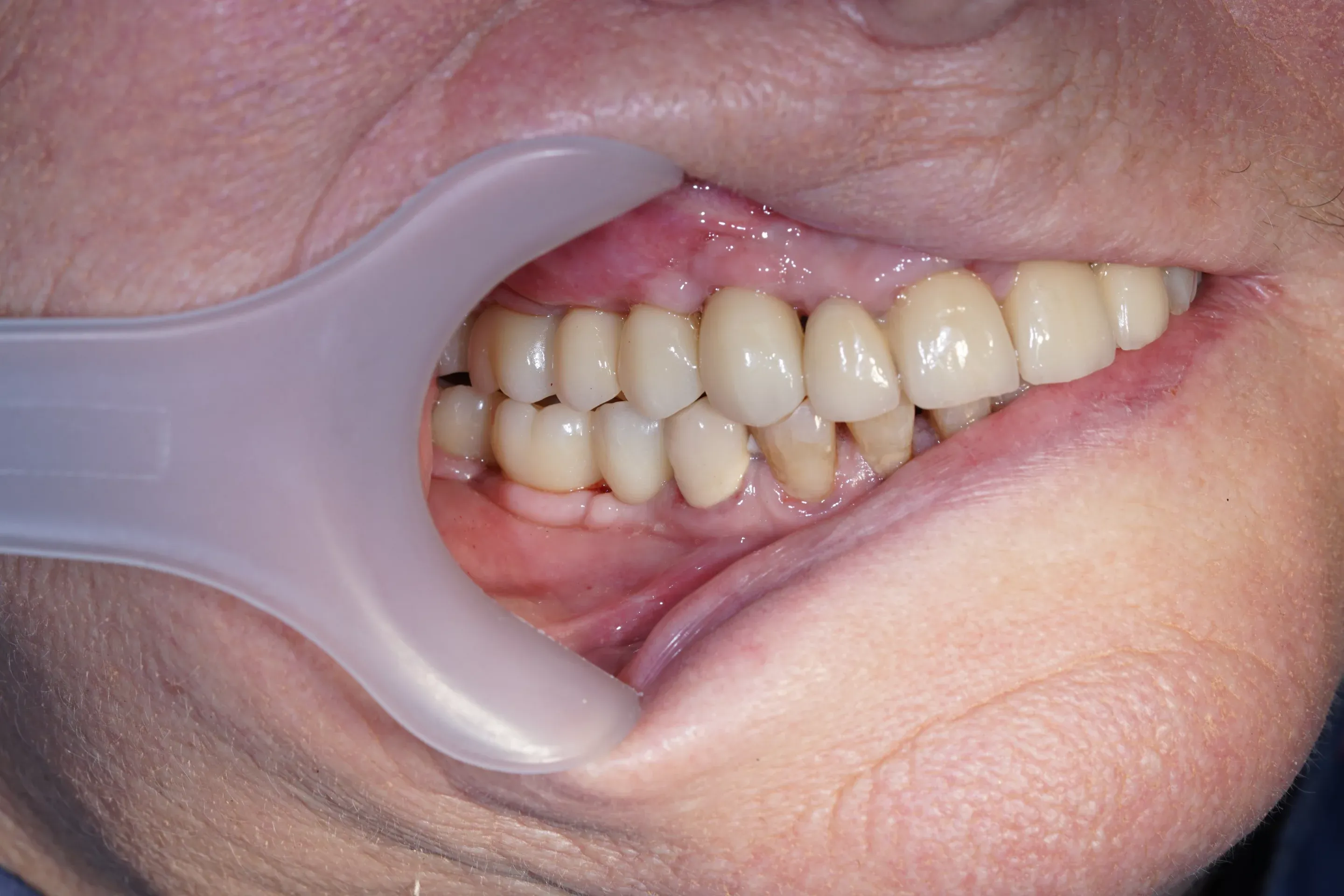 Image two