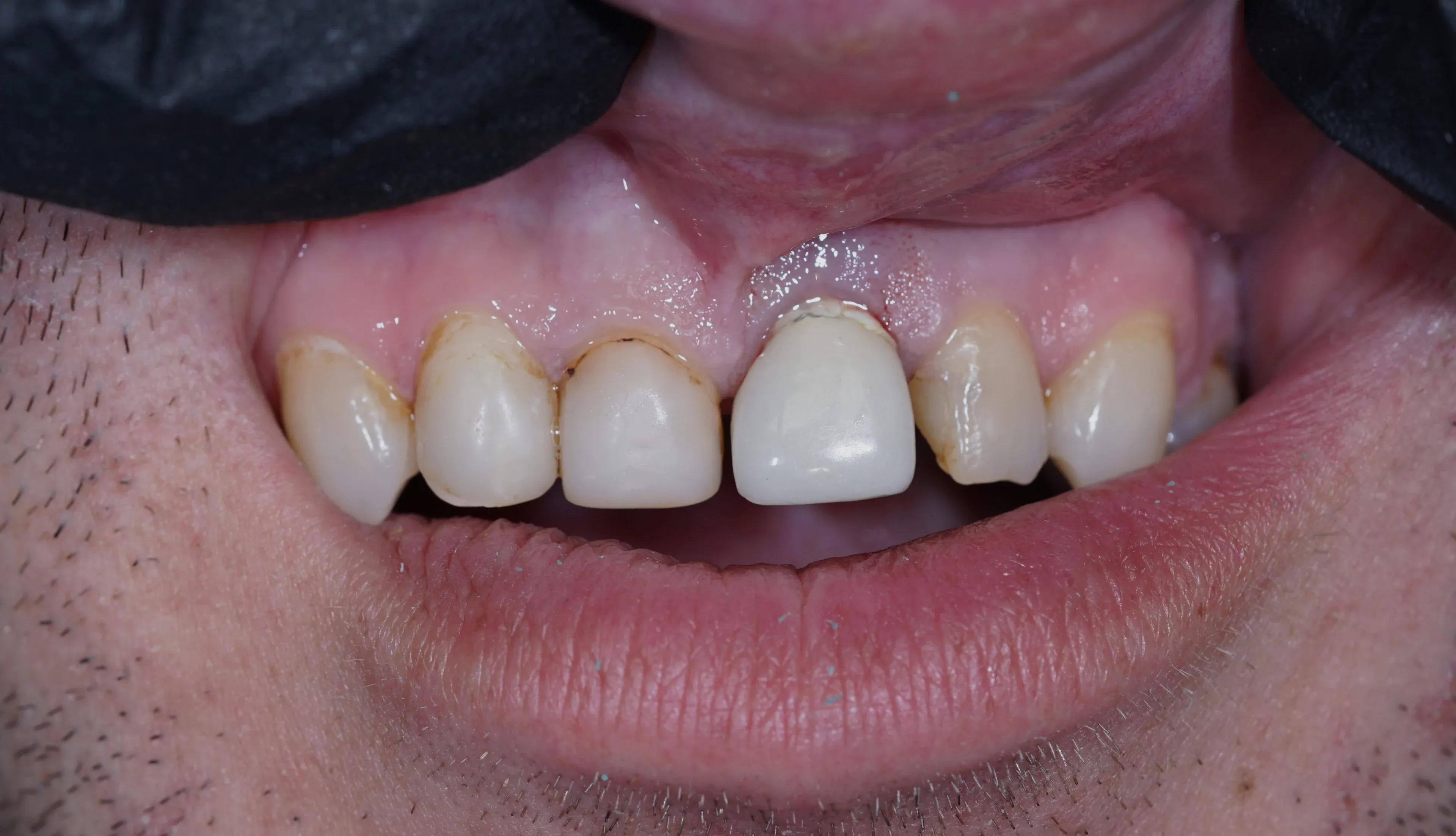 Image two