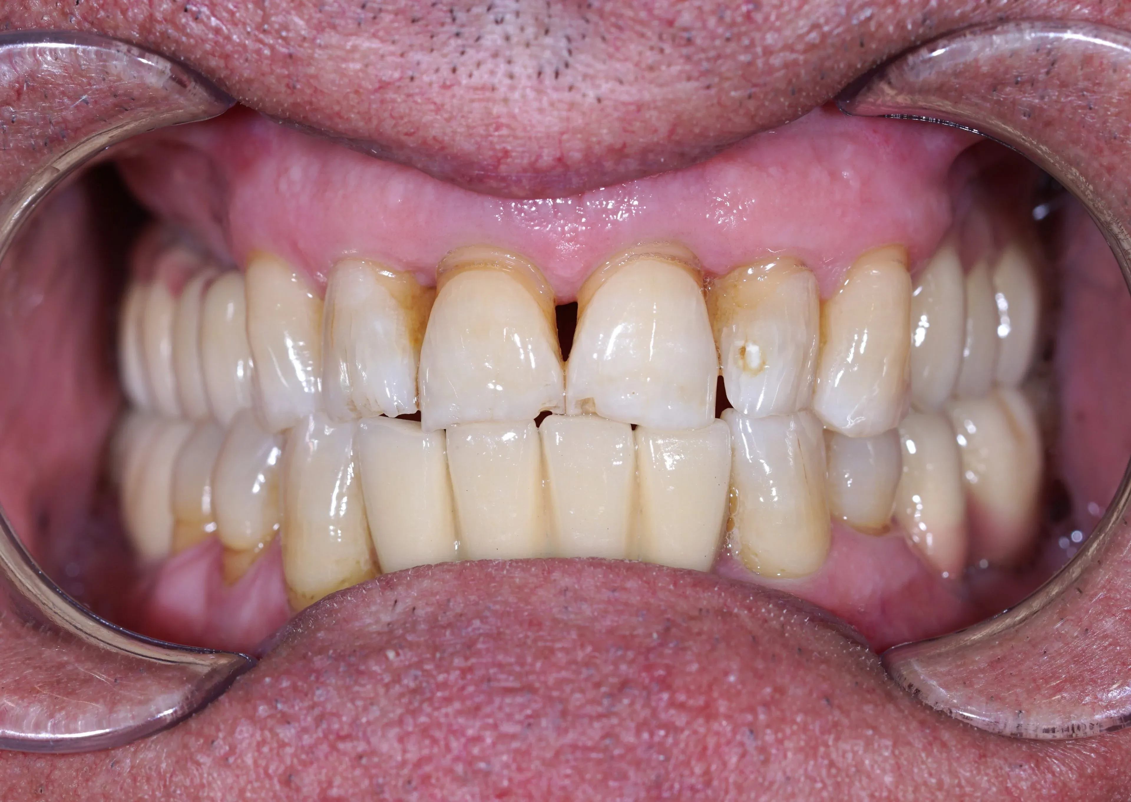 Image two
