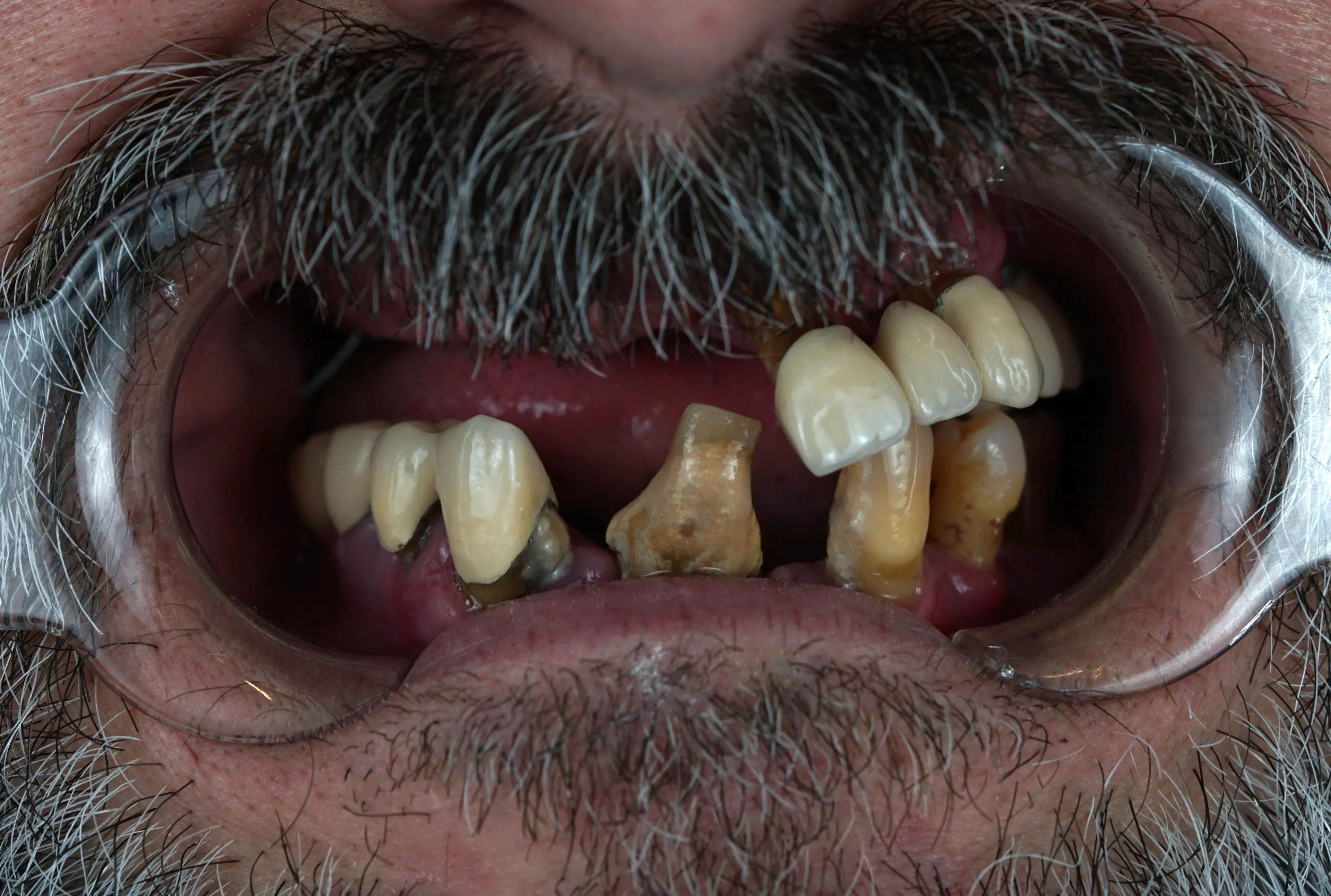 Image one