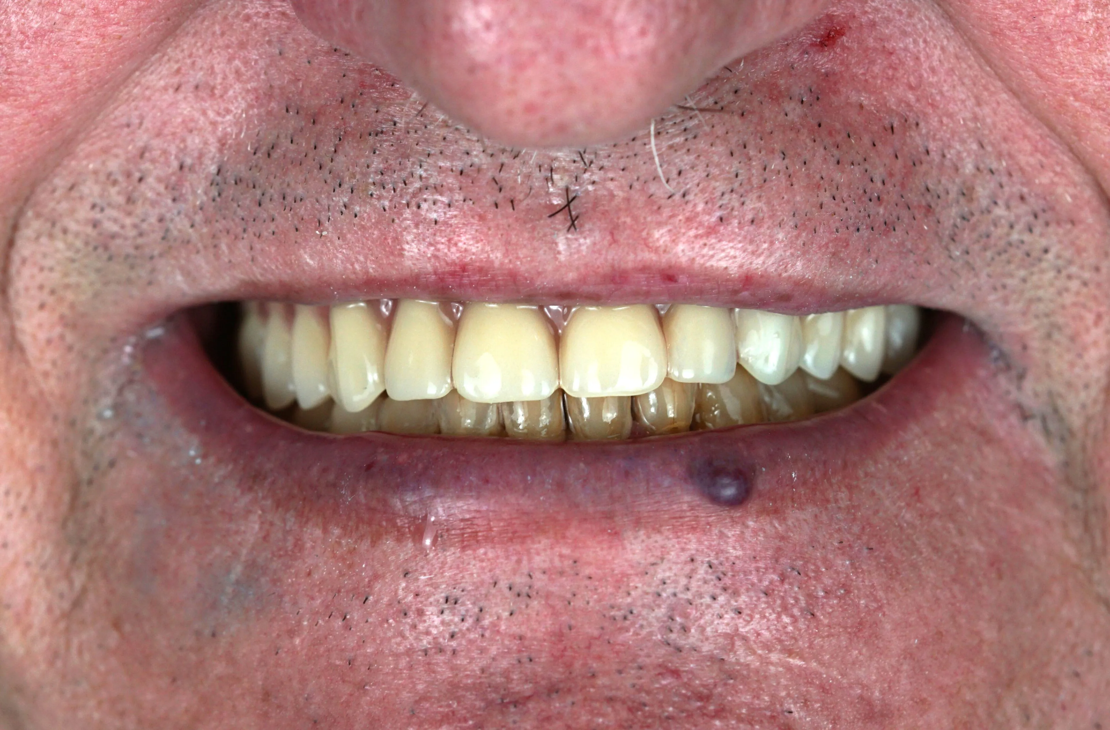 Image two