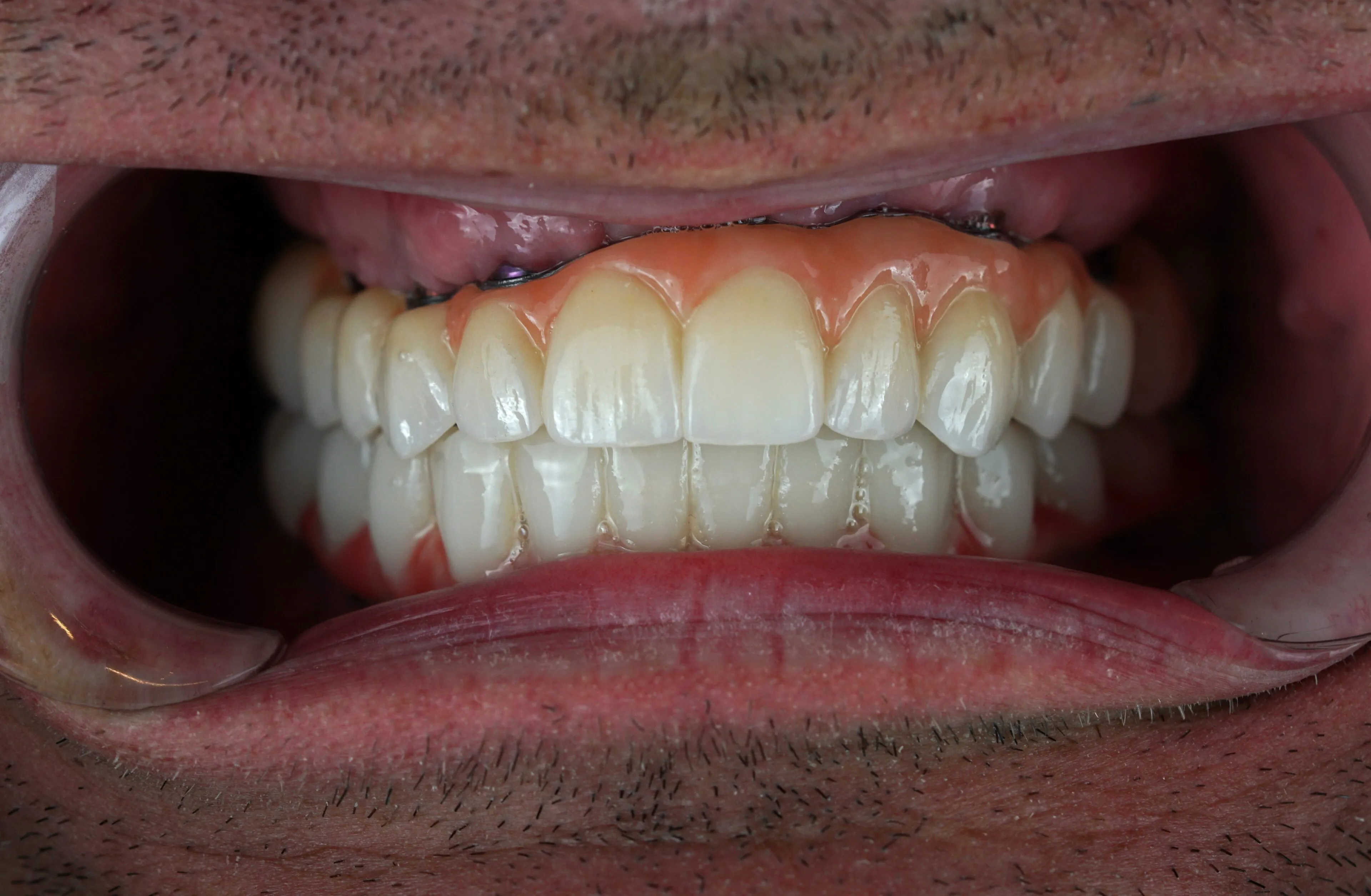 Image two