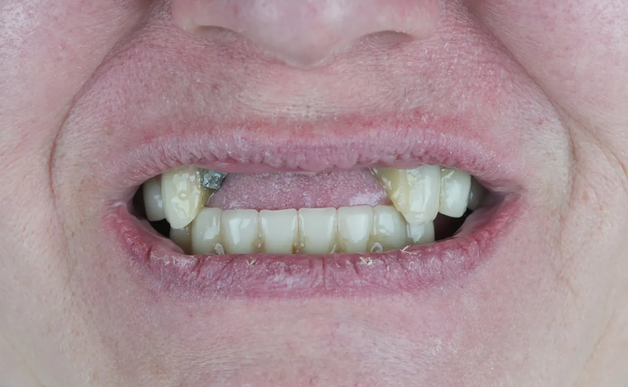 Image one
